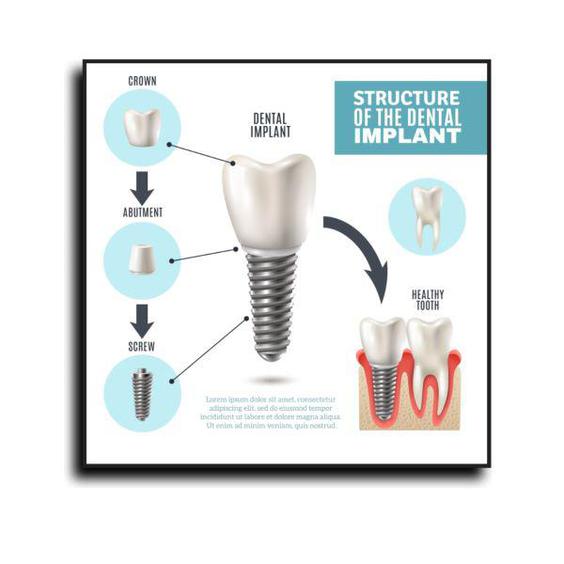 تابلو مدل مطب دندانپزشکی  کد b10|دیجی‌کالا