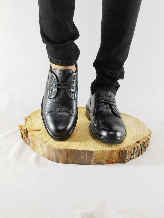 کفش اداری طبی مردانه مدل گلد بندی رویه خطی|پیشنهاد محصول