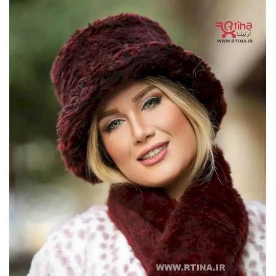 شال و کلاه زمستانه دخترانه و زنانه زرشکی مدل فرحی خزدار|پیشنهاد محصول