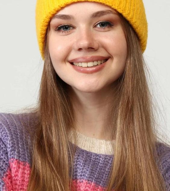 کلاه بافتنی راه راه زنانه زرد|پیشنهاد محصول
